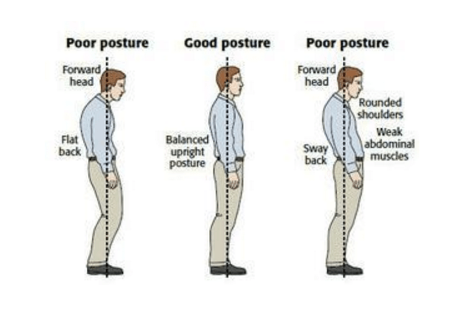 Attēla avots: http://www.thephysiocompany.com/blog/stop-slouching-postural-dysfunction-symptoms-causes-and-treatment-of-bad-posture