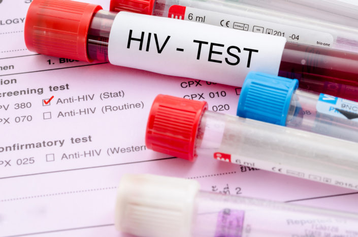 HIV tests