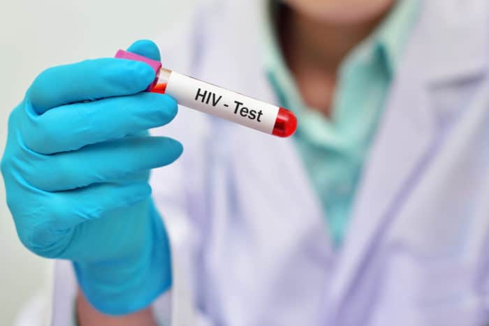 HIV asins analīzes